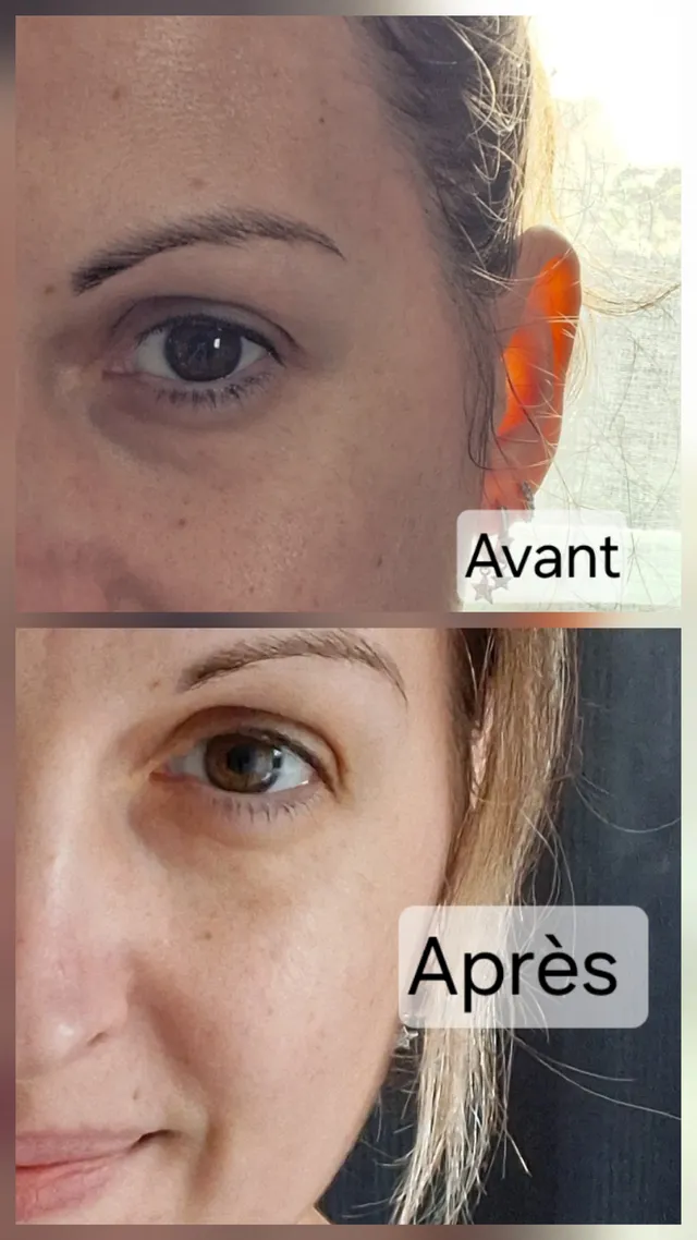 Je l’applique le soir sur peau propre, après le nettoyage, à